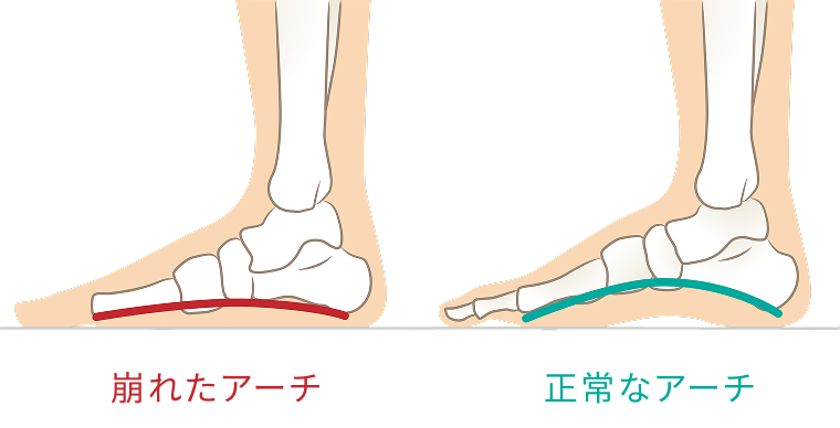 ニッティド｜5本指ソックス